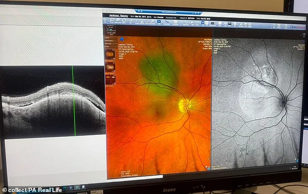 A Black Dot That Changed Everything: Tammy Jackson's Eye Cancer Journey