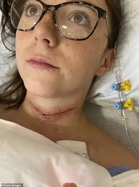 A Young Woman's Fight Against Thyroid Cancer: 'I Never Expected This' – Experts Urge Early Detection and Awareness