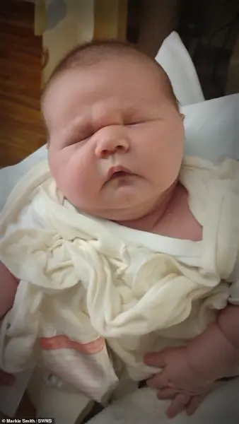 Astonishing Story: Arlington Mother Welcomes 13-Pound Baby Weighing the Same as a Bowling Ball via Emergency C-Section