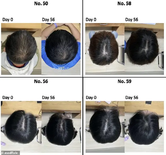Breakthrough in Hair Regrowth: 'This Could Change Everything' Says Scientist Behind Centella asiatica Serum