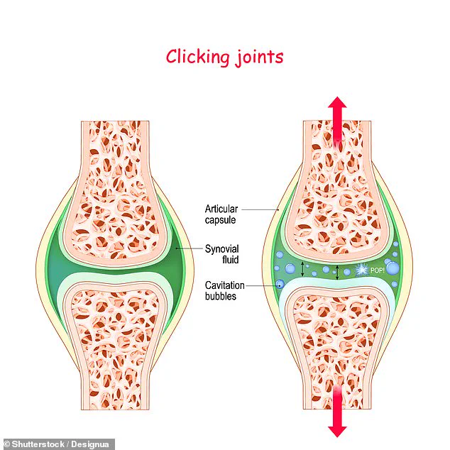 Cracking Knuckles Doesn't Cause Arthritis: The Science Behind Joint Noises