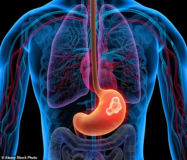 Expert Warns: Indigestion May Signal Serious Health Risks, Urging Public to Seek Timely Medical Advice