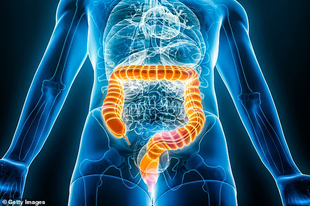 Global Surge in Bowel Cancer Among Young People Raises Alarms as Some Nations See Smaller Increases