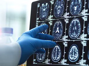 New Research Highlights 17 Lifestyle Factors Critical in Preventing Alzheimer’s and Vascular Dementia