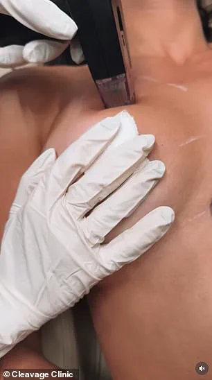 Surge of Young Women Seek Non-Surgical Breast Enhancements at Cleavage Clinic