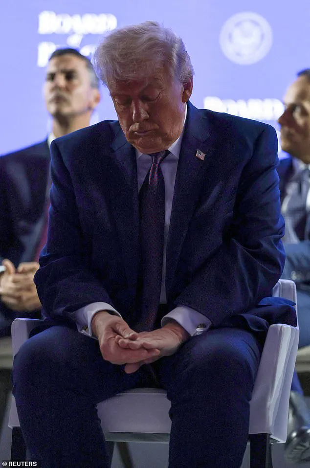 Trump's Davos Bruise: 'Minor Accident' Says President, as Public and Medical Experts Weigh Health Implications