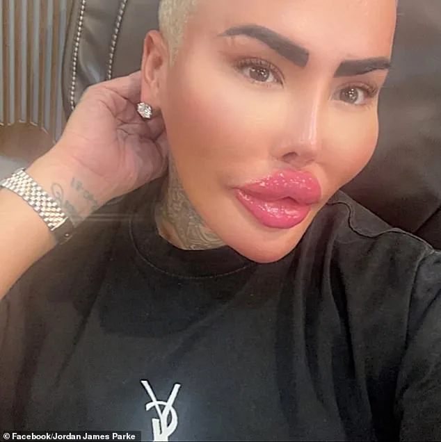 Sudden Death of 'The Lip King' Reignites Scrutiny Over Cosmetic Procedure Risks, Two Arrested in Manslaughter Probe