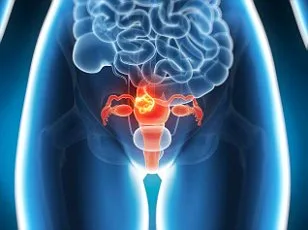 Laura Liddle's Three-Year Battle with Untreated Genital Pain Misdiagnosed as Yeast Infection