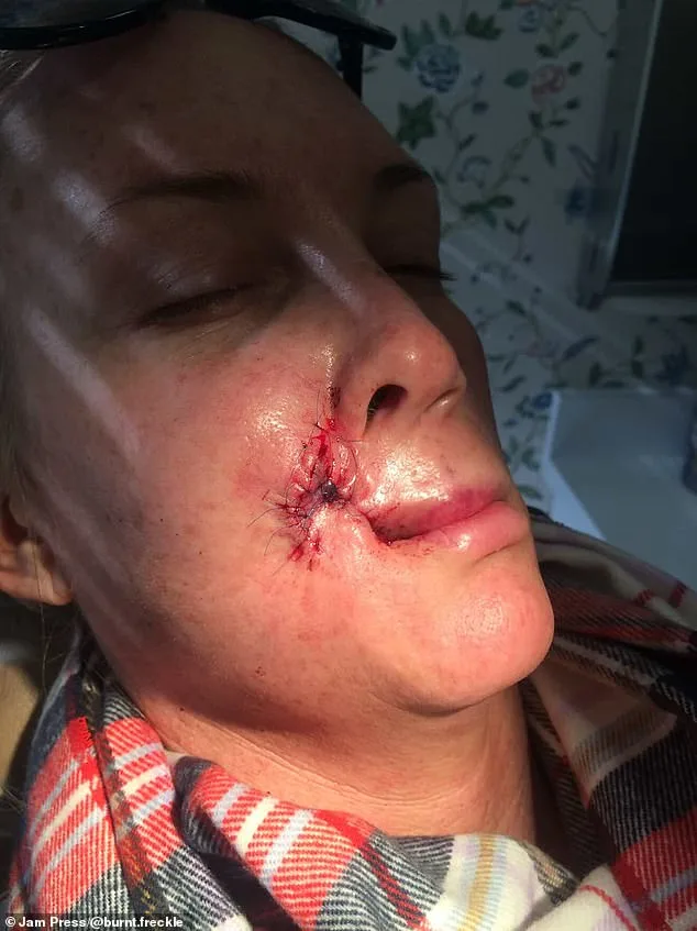 Kory Feltz: Living in Fear of Recurrent Skin Cancer