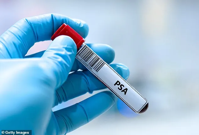 Cheap Diabetes Drug Metformin Cuts Prostate Cancer Risk by 35%, Study Reveals