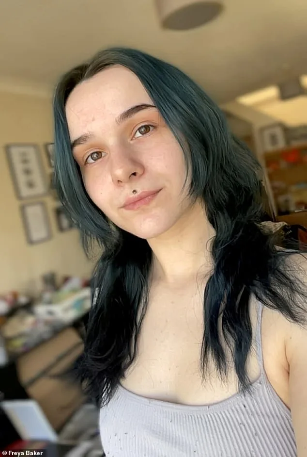 Hyperhidrosis: How Freya Baker's Condition Has Shattered Her Confidence and Career