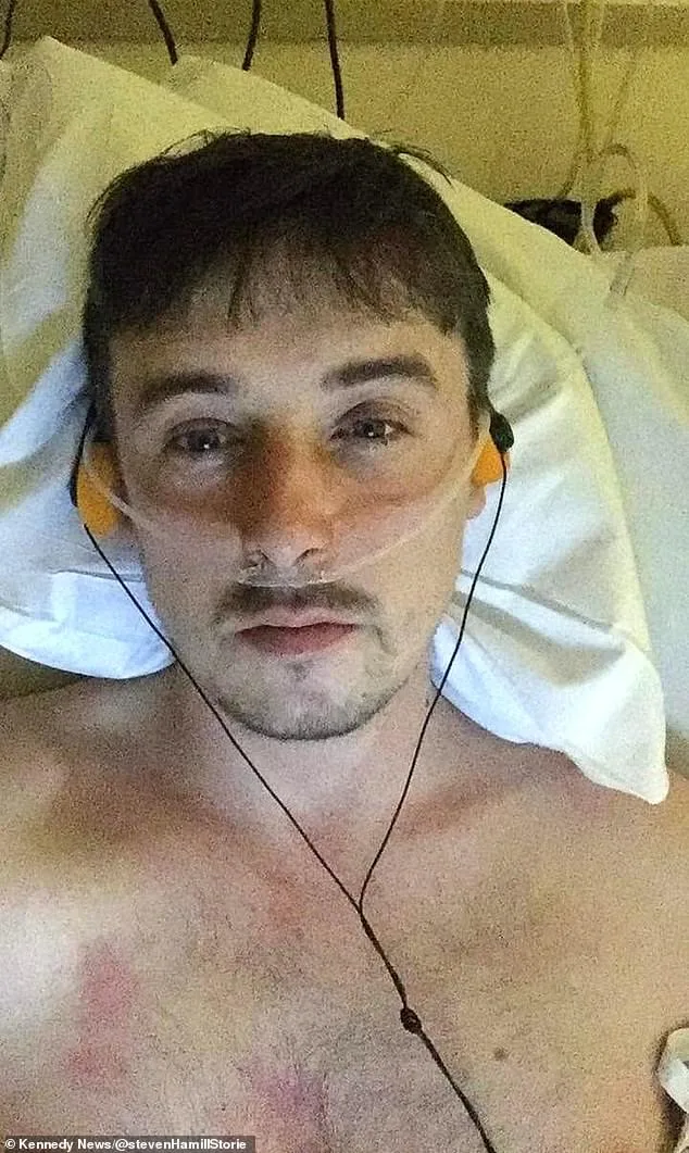 From Balanitis to Penile Cancer: A Journey of Misdiagnosis and Resilience