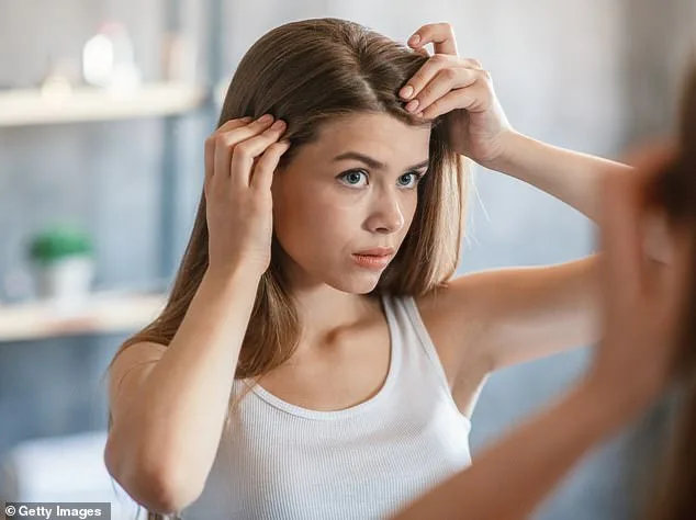 Dandruff Myth Debunked: The Real Cause Behind the Itch and Flakes